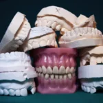 Maximising Your Denture Repair: How to Get the Best Results from Your Repair Services