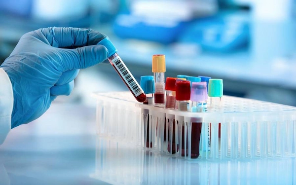 What are Top 10 Benefits of Routine Blood Tests Packages?