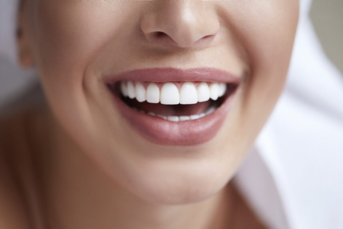 5 Things to Look For in Affordable Dentistry