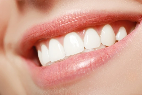 From Food to Flossing: The Best Habits for a Beautiful Smile